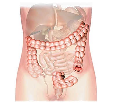 anastomose intestinale